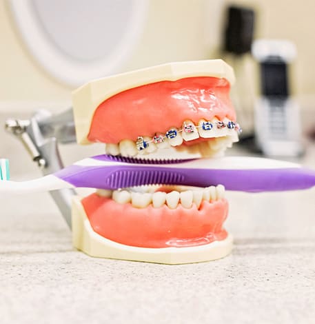 Orthodontics | Assiniboine Dental Group | St. James, Winnipeg Dentist