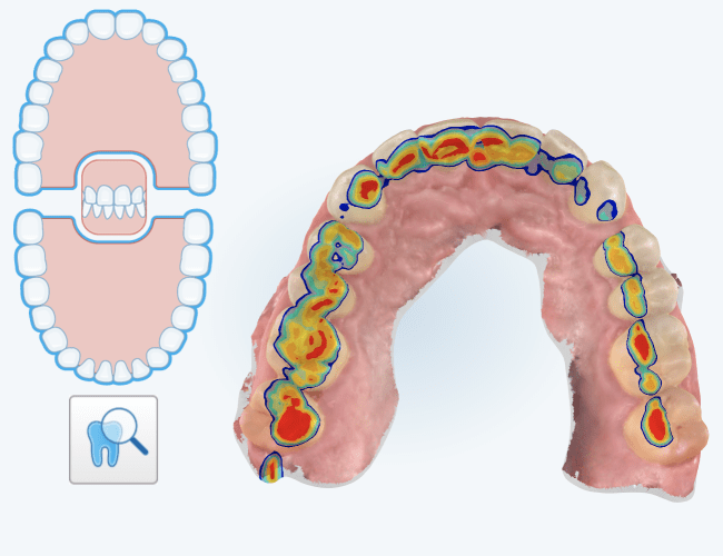 Digital Wellness Scans, Winnipeg Dentist